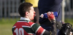 Beavers Come From Behind To Win Thriller At Beaver Park A thrilling match and a terrific second half. At halftime Beverley RUFC were down and out. They trailed 17-5; their influential fly half was on his way to hospital with a suspected broken leg, and a red card had reduced them to fourteen.